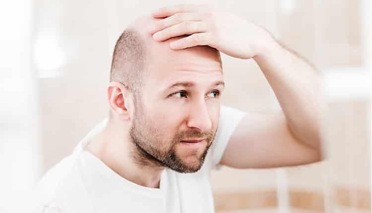 روش های کاشت مو با بانک موی ضعیف کدامند؟ روش های کاشت مو با بانک موی ضعیف کدامند؟