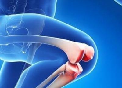 عمل آرتروپلاستی چیست و چگونه انجام می شود؟